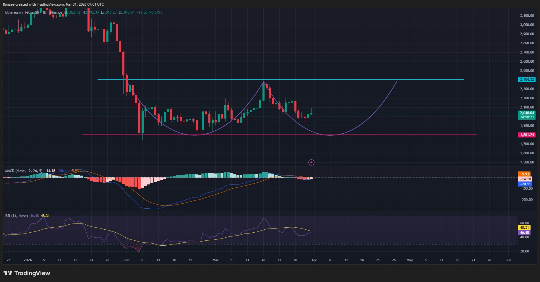 Ethereum price outlook as Bitmine acquires another 71,179 ETH